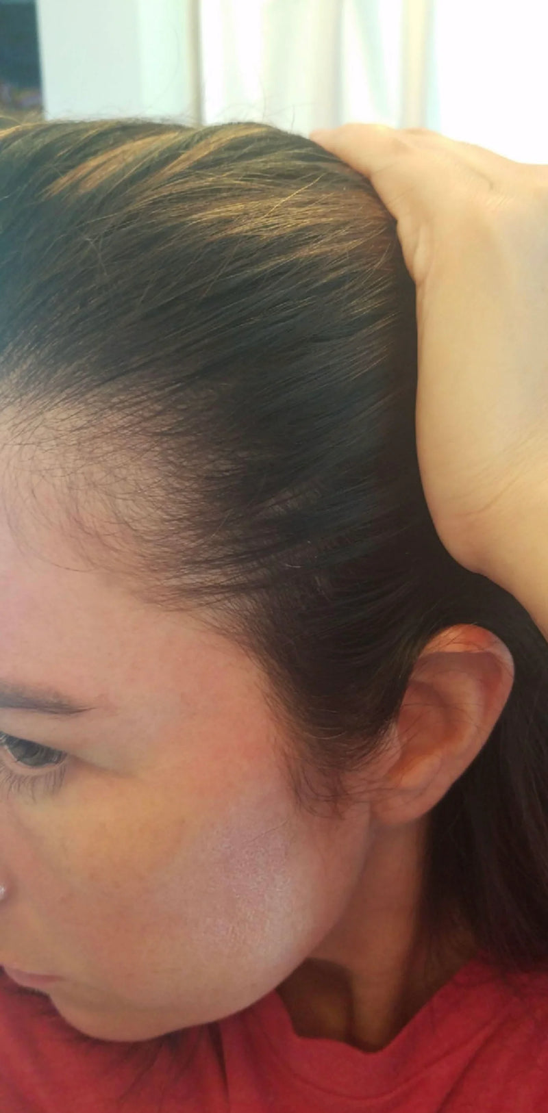 Kirkland Minoxidil 5% - Hairloss treatment - Hairdealz.com