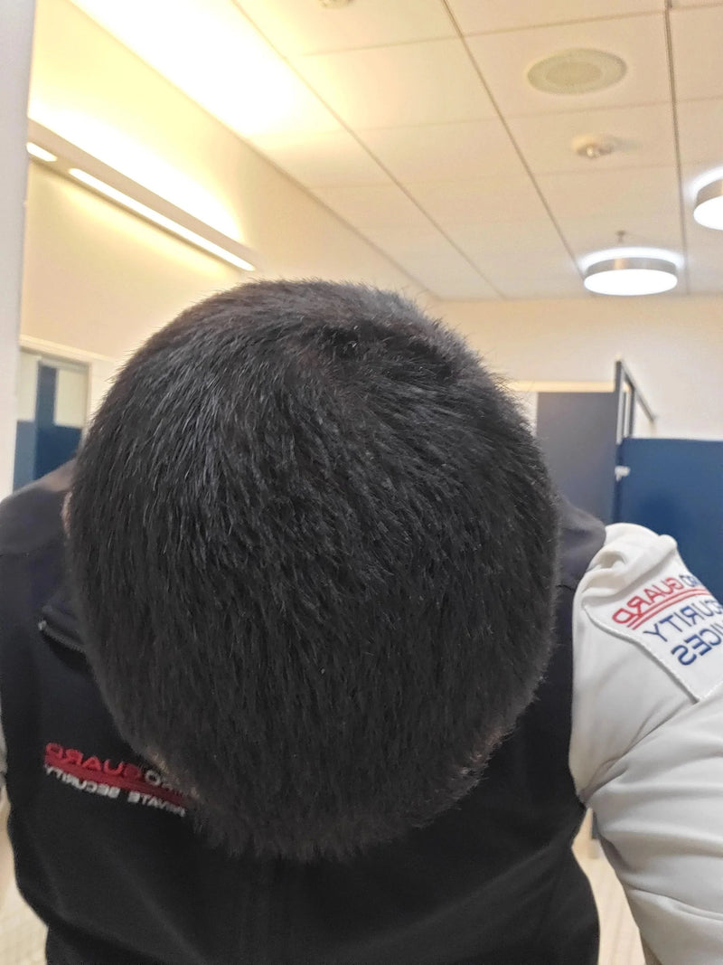 Kirkland Minoxidil 5% - Hairloss treatment - Hairdealz.com