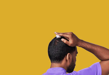 Kirkland Minoxidil 5% - Hairloss treatment - Hairdealz.com