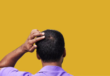 Kirkland Minoxidil 5% - Hairloss treatment - Hairdealz.com