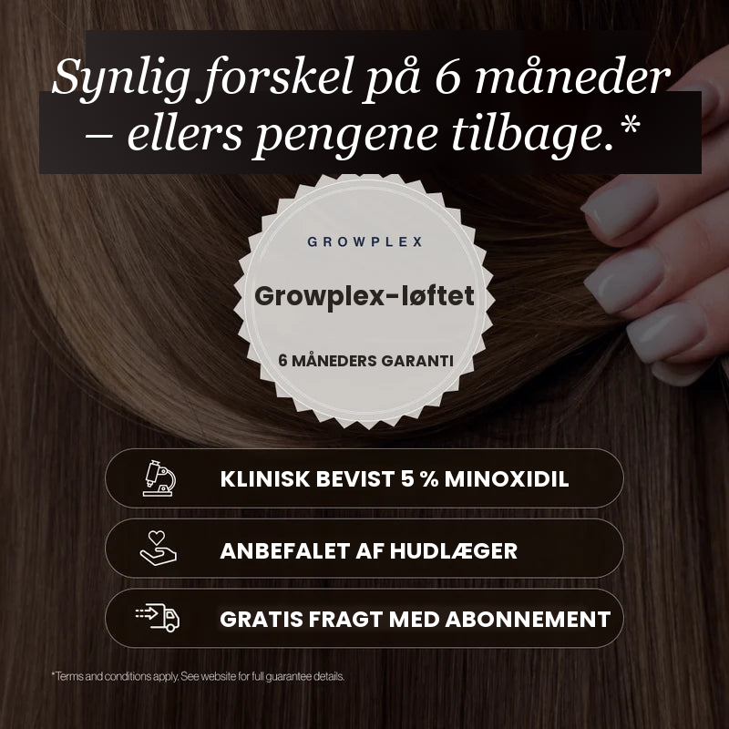 Growplex VitaFoam Minoxidil Skum 5% - synlig forskel efter 6 måneder