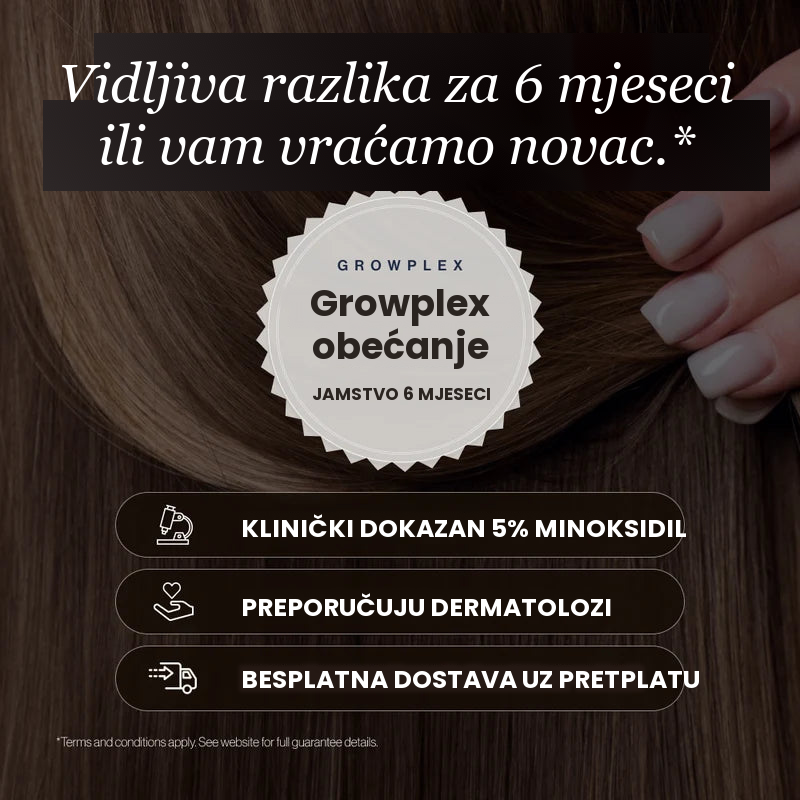 Growplex VitaFoam minoksidil pjena 5% - vidljiva razlika nakon 6 mjeseci