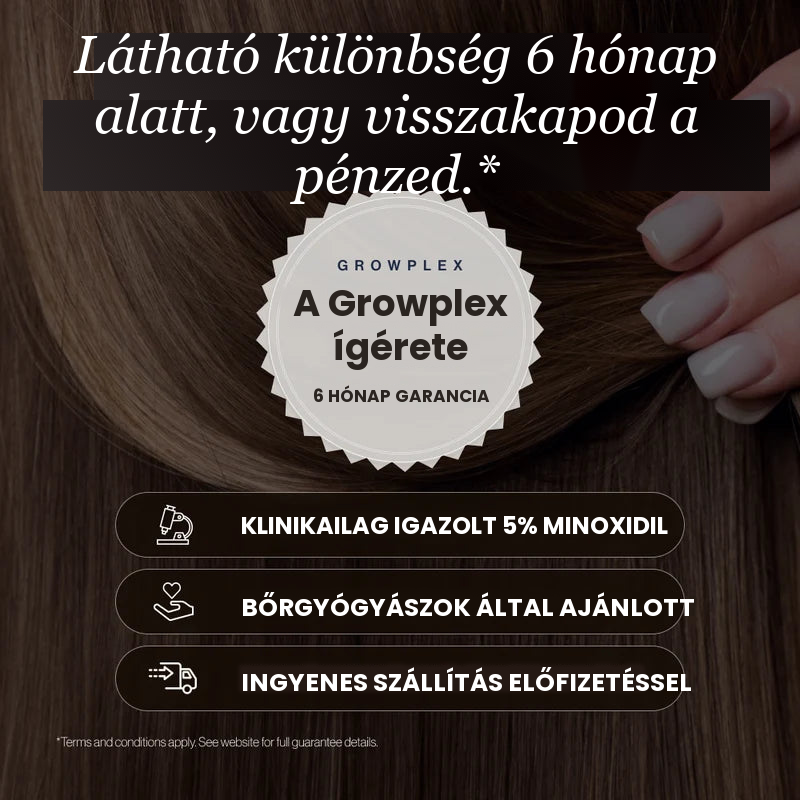 Growplex VitaFoam Minoxidil 5% hab – látható különbség 6 hónap alatt