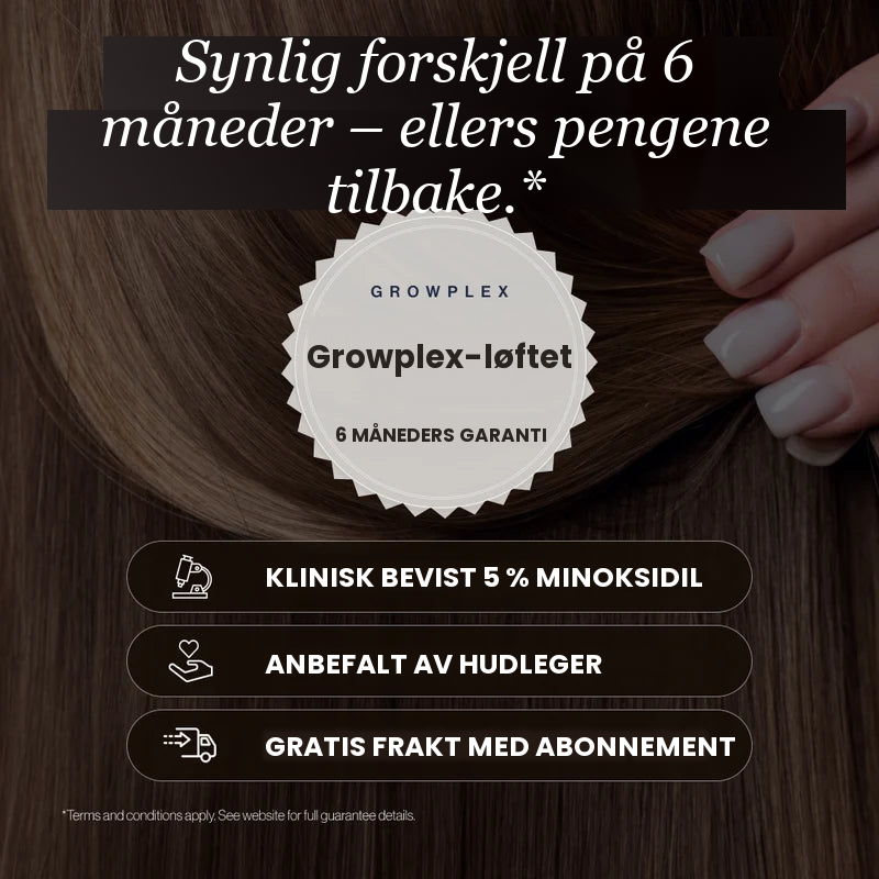 Growplex VitaFoam Minoxidil skum 5% – synlig forskjell etter 6 måneder