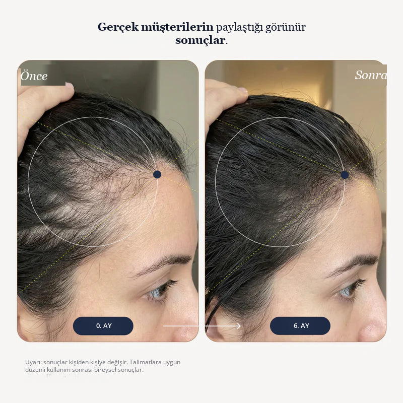 Growplex VitaFoam Minoxidil Foam 5%