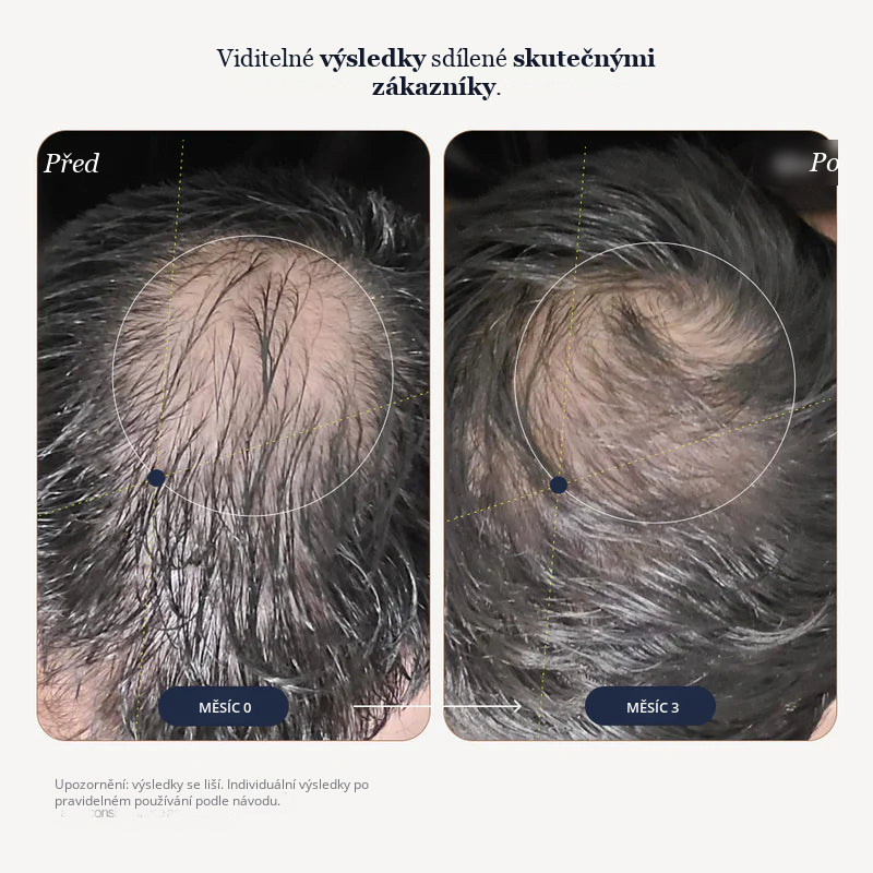 Growplex VitaFoam Minoxidil pěna 5%