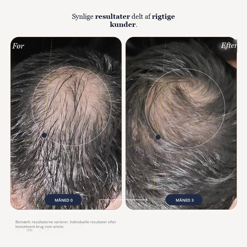 Growplex VitaFoam Minoxidil Skum 5%
