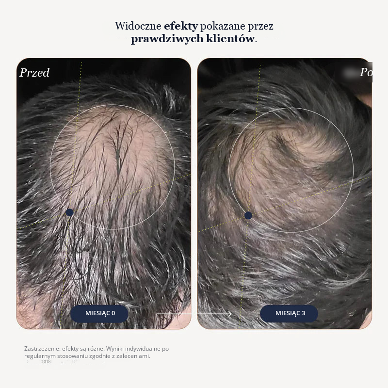 Growplex VitaFoam Pianka z Minoksydylem 5%
