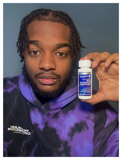 Kirkland Minoxidil 5% - Hairloss treatment - Hairdealz.com