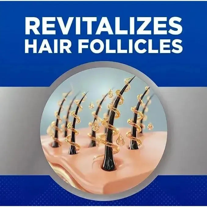 Kirkland Lotion 5% for Men (6-Month Supply)