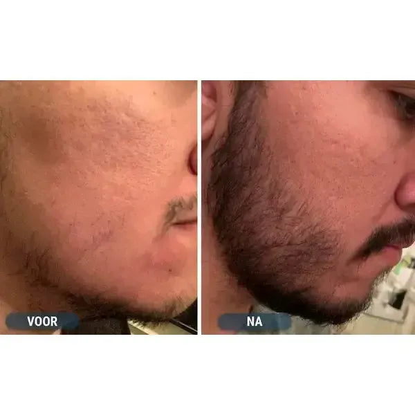 Kirkland Lotion 5% for Men (6-Month Supply)