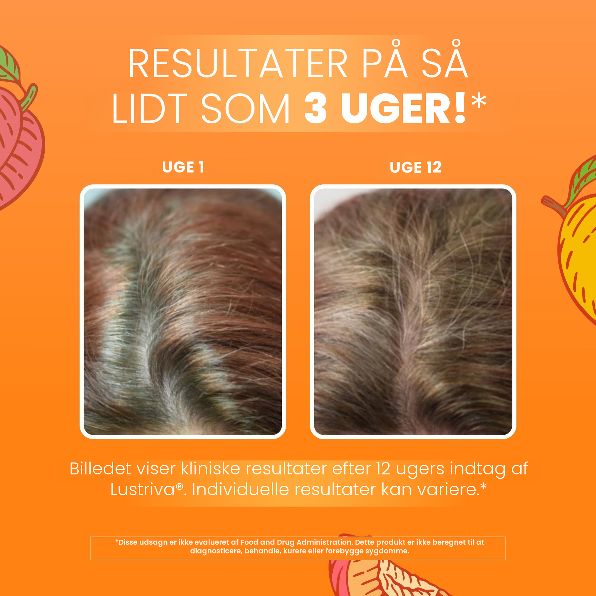 MaryRuth Organics' kliniske billeder for Lustriva, der viser håret i uge 1 sammenlignet med uge 12