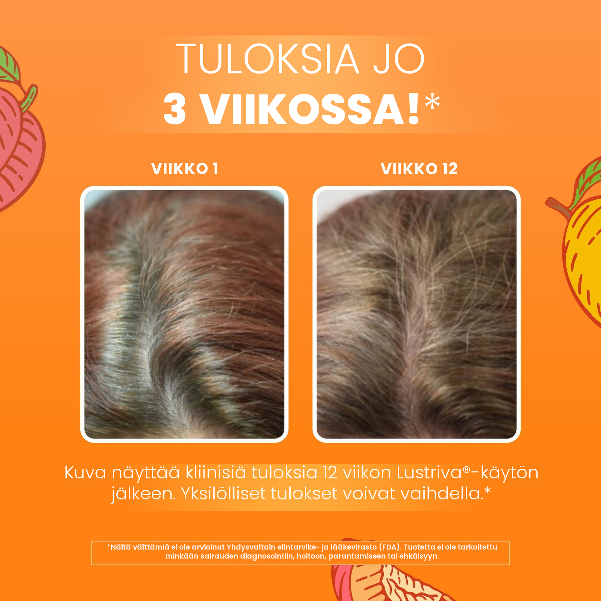 MaryRuth Organicsin kliininen kuvamateriaali Lustrivasta, hiukset viikolla 1 verrattuna viikkoon 12