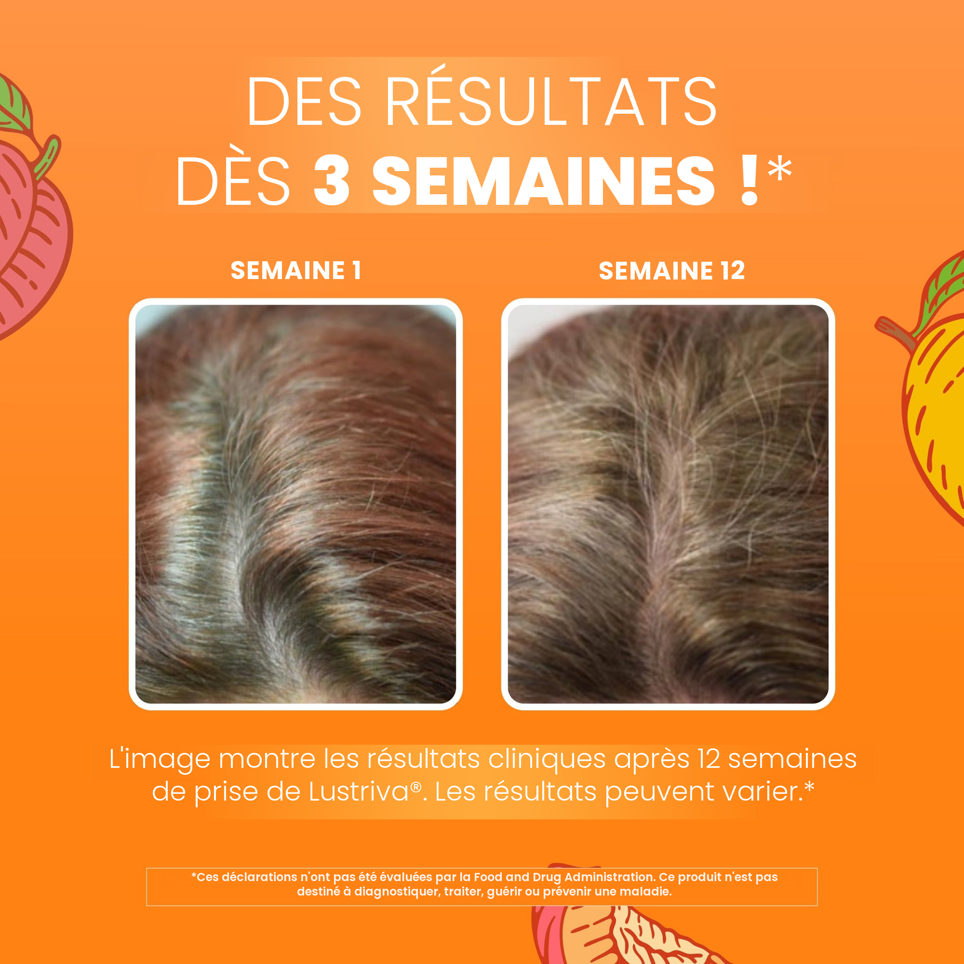 Images cliniques MaryRuth Organics pour Lustriva : cheveux à la semaine 1 à côté de la semaine 12