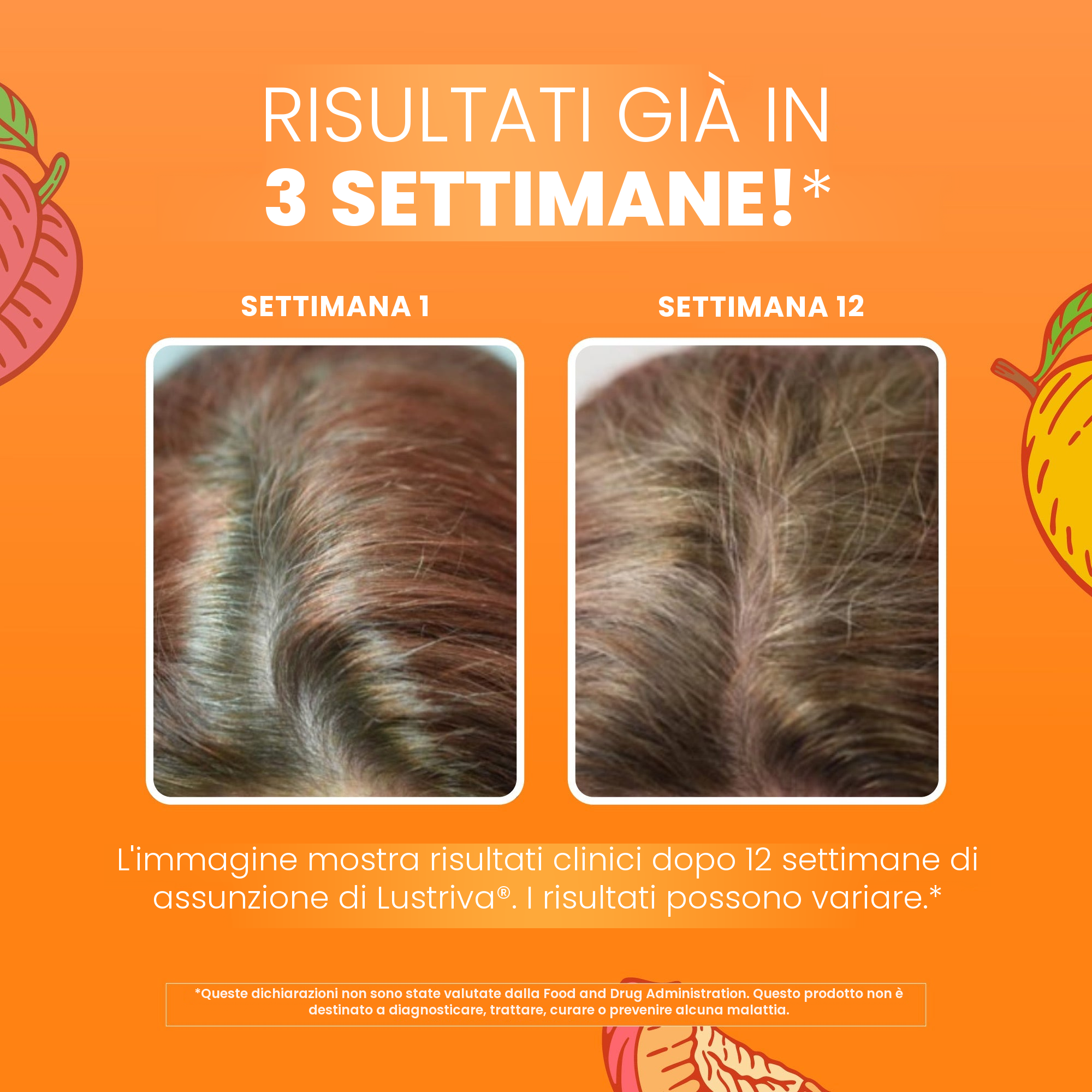 Immagini cliniche MaryRuth Organics per Lustriva: capelli alla settimana 1 accanto alla settimana 12