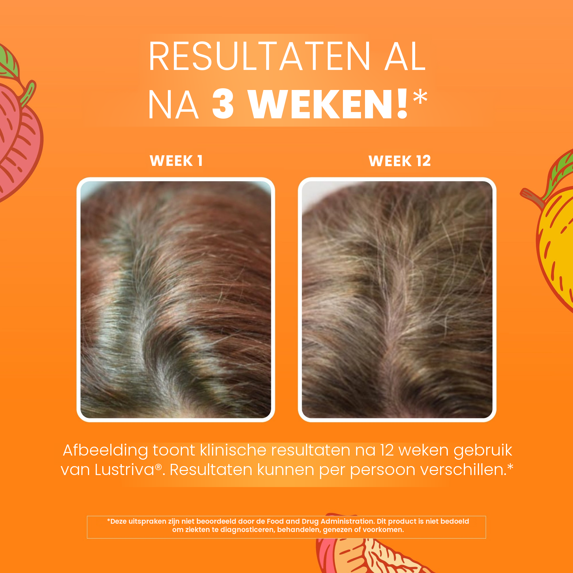 Klinisch beeldmateriaal van MaryRuth Organics voor Lustriva: haar in week 1 naast week 12