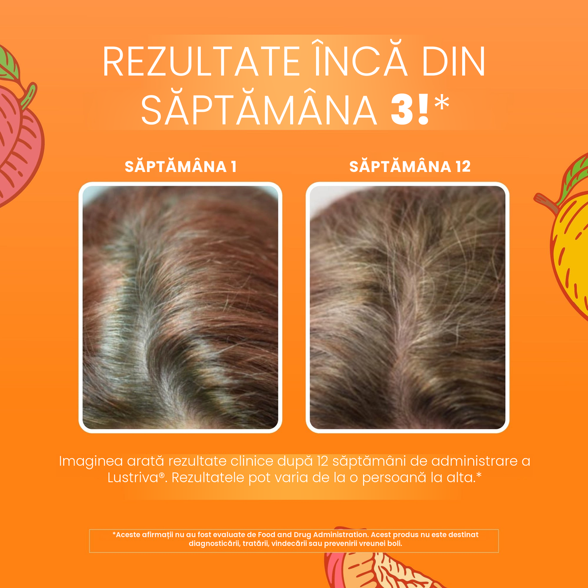 Imagini clinice MaryRuth Organics pentru Lustriva, care arată părul în săptămâna 1 comparativ cu săptămâna 12