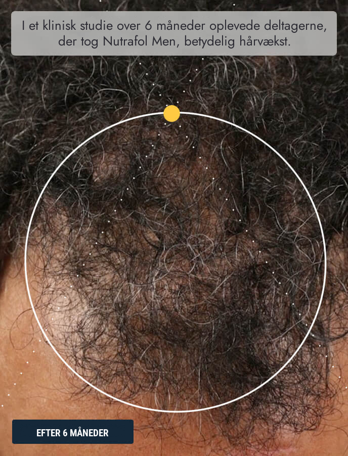 Nutrafol til Mænd (120 kapsler)