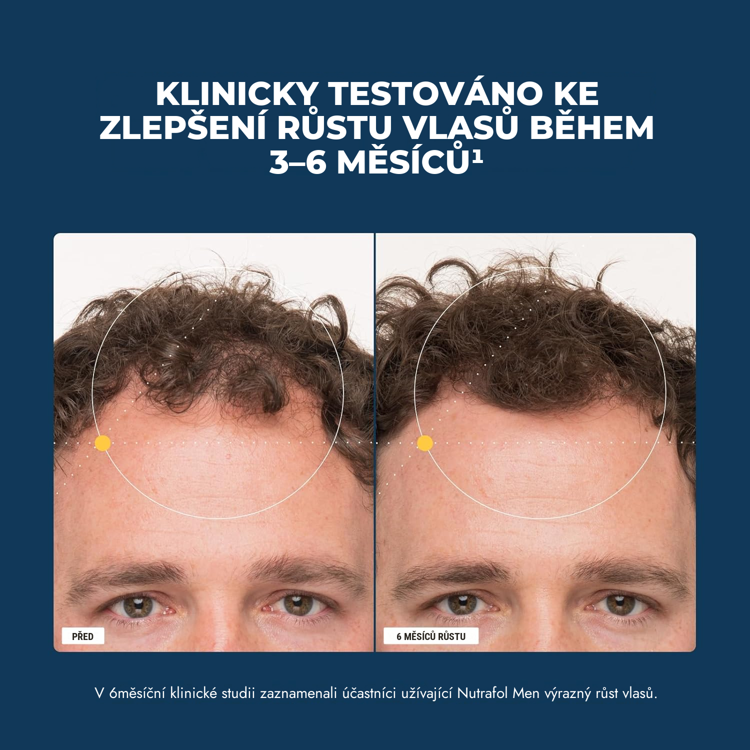 Nutrafol pro muže (120 kapslí)
