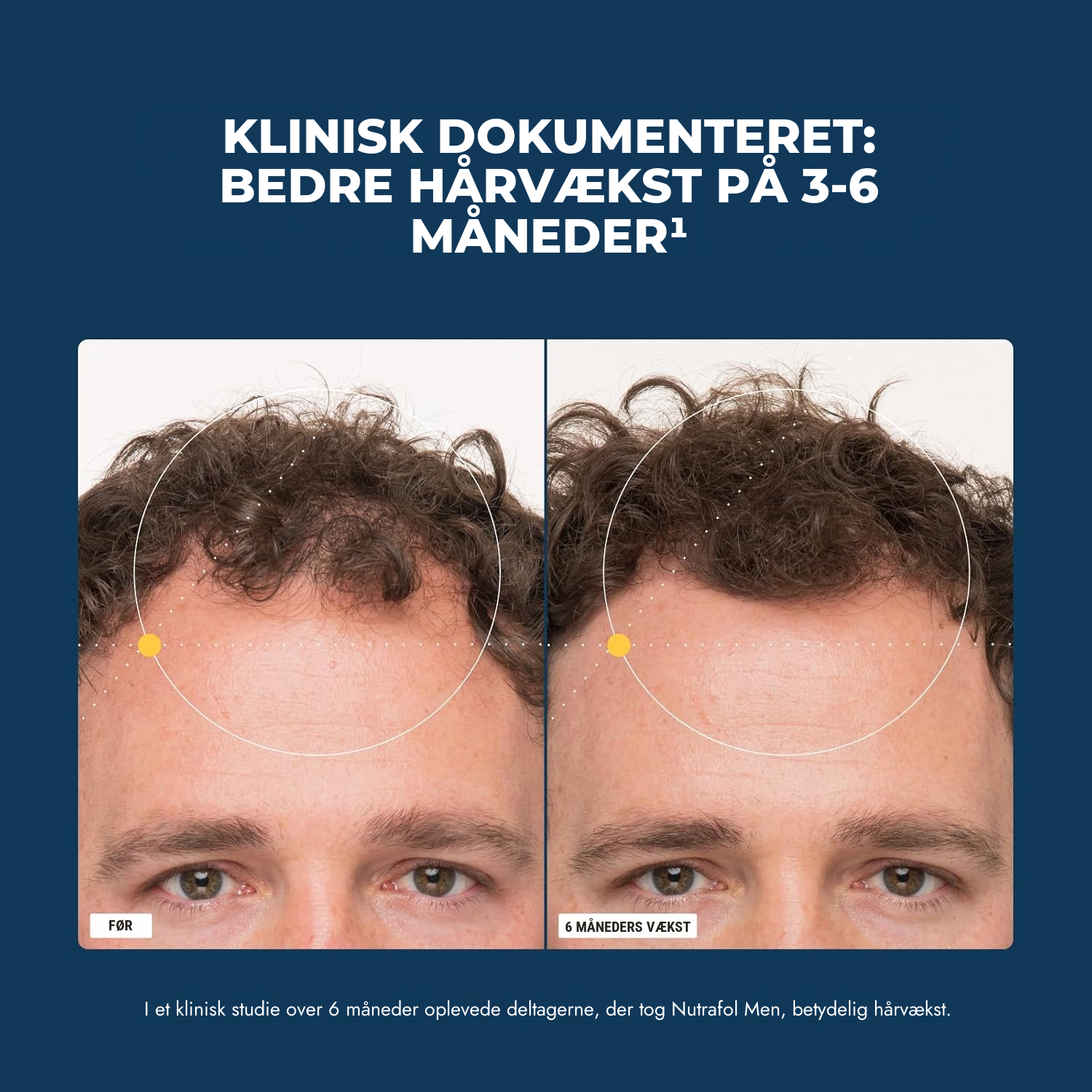 Nutrafol til Mænd (120 kapsler)