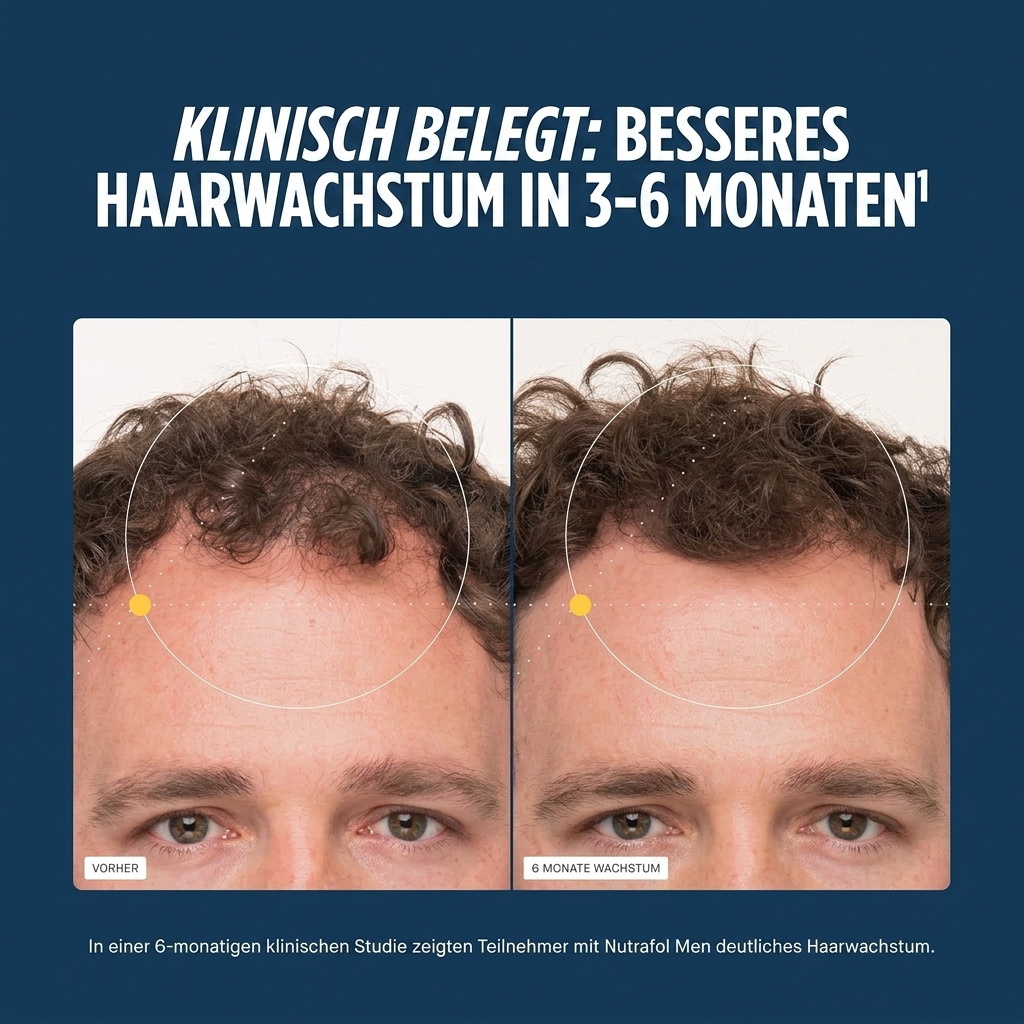 Nutrafol für Männer (120 Kapseln)