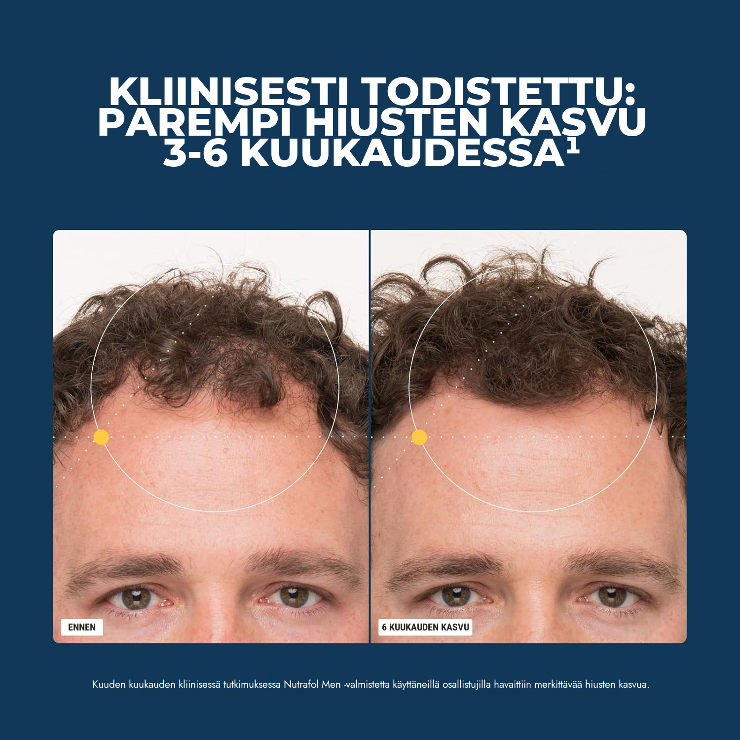 Nutrafol miehille (120 kapselia)