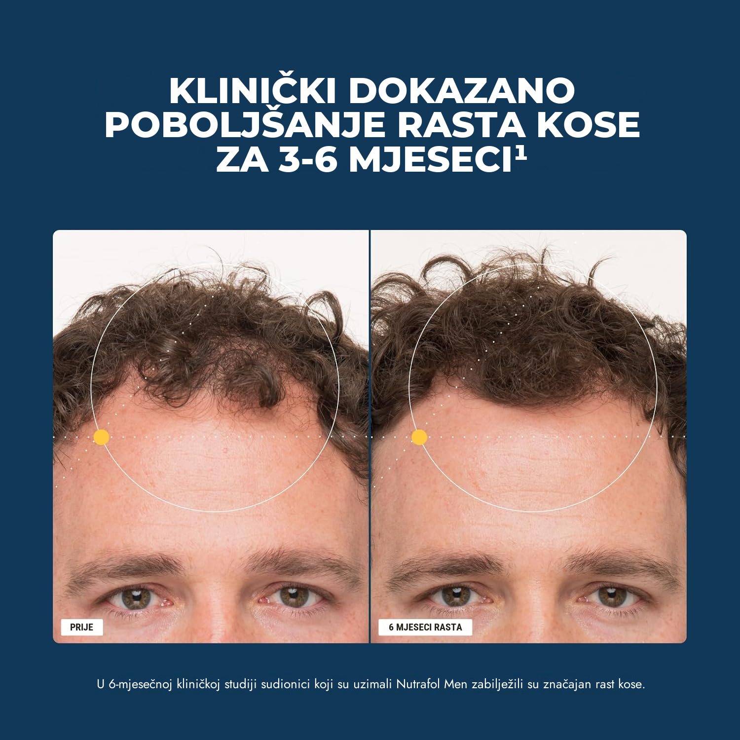 Nutrafol za muškarce (120 kapsula)