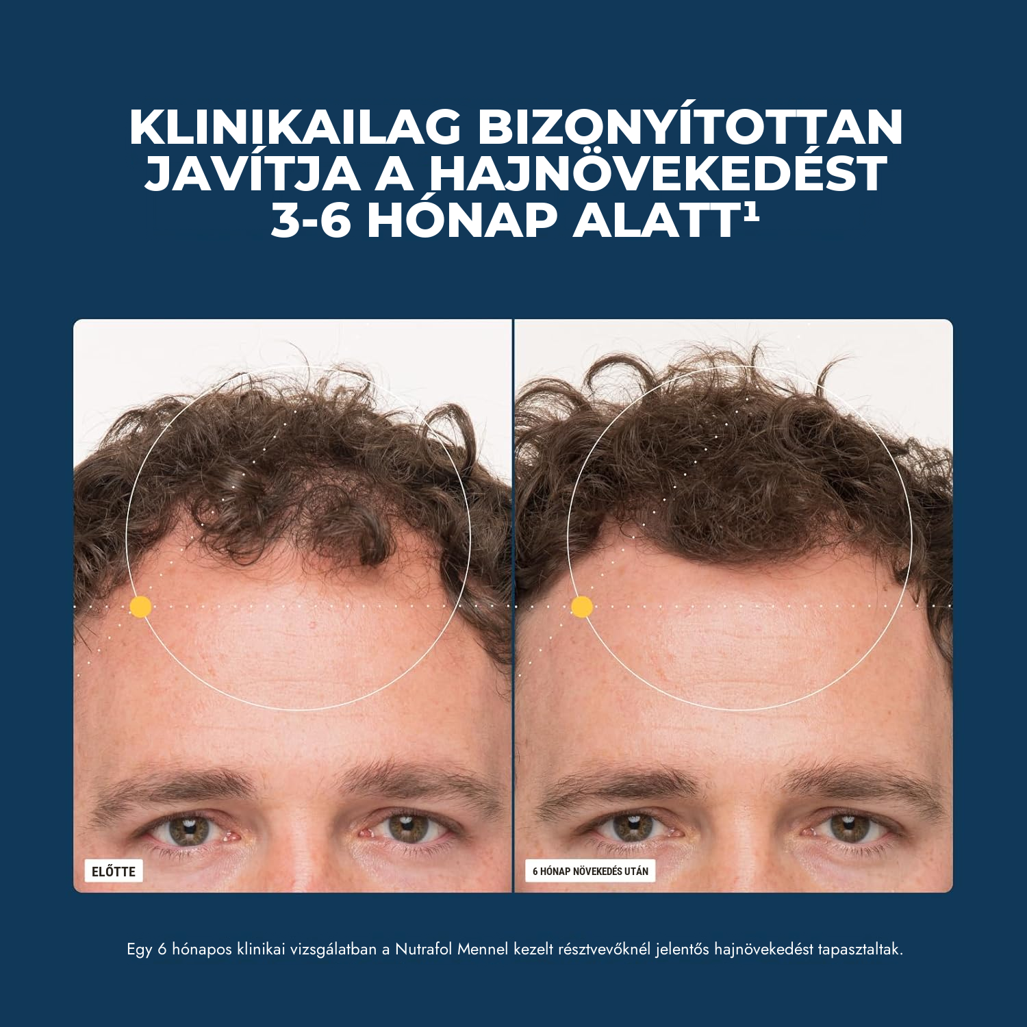Nutrafol férfiaknak (120 kapszula)