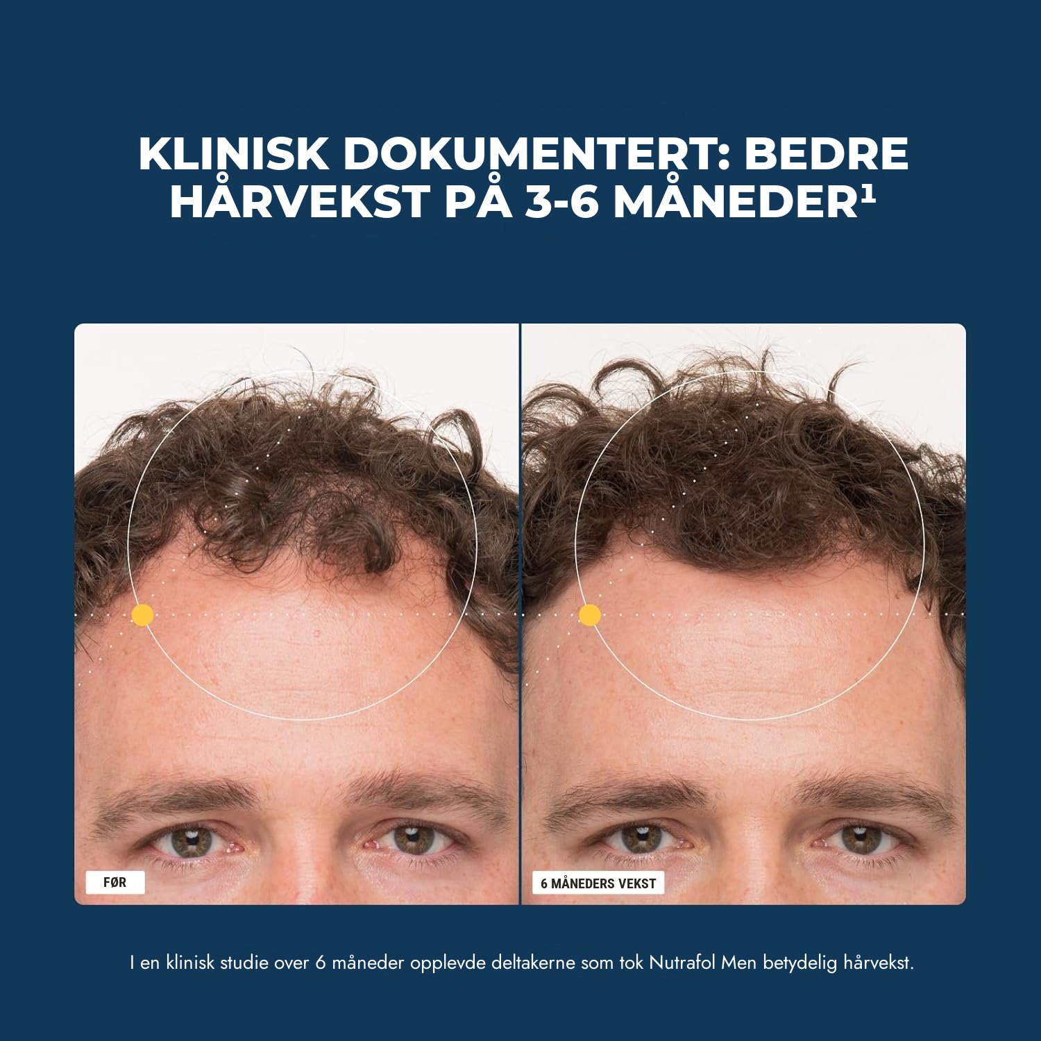 Nutrafol for menn (120 kapsler)