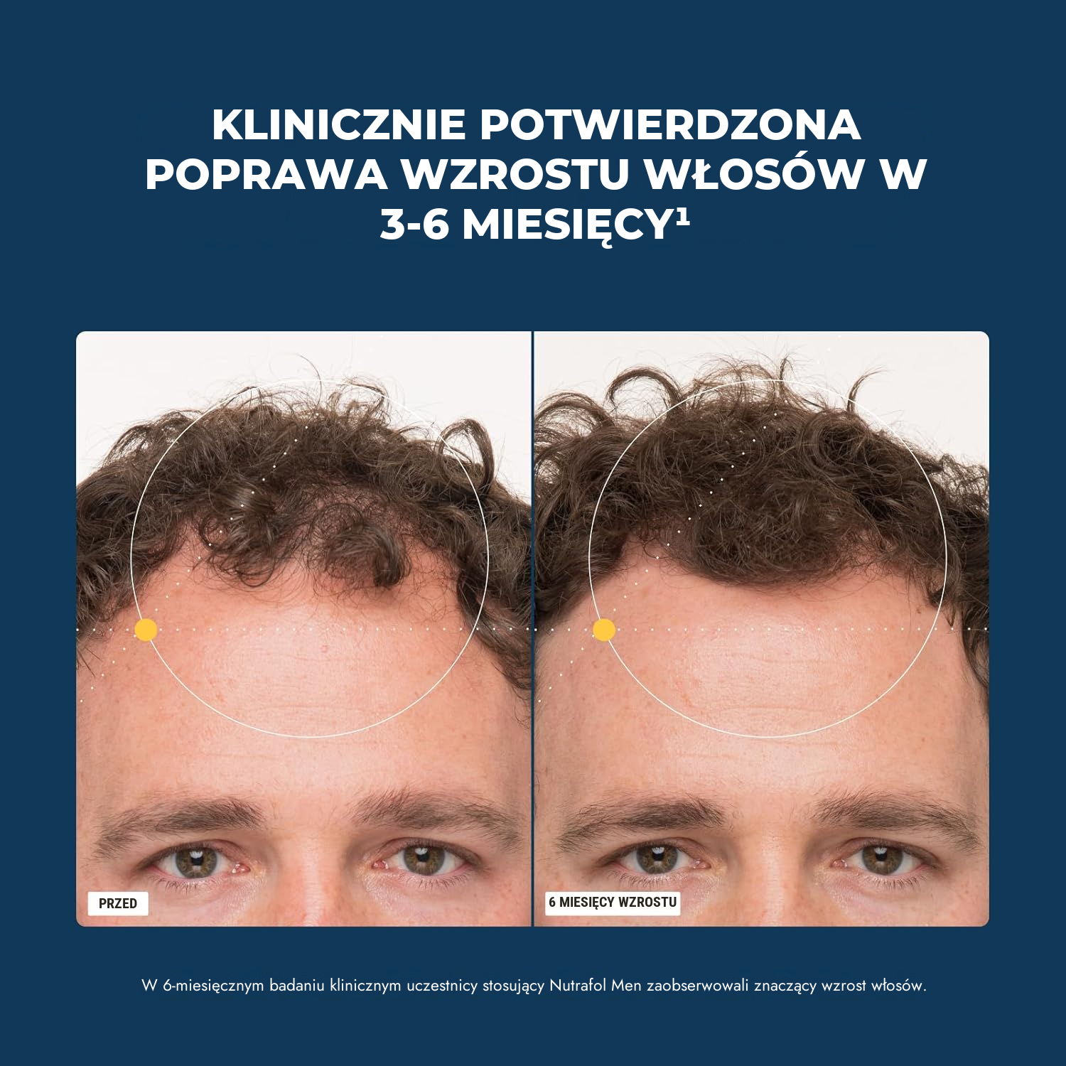 Nutrafol dla mężczyzn (120 kapsułek)