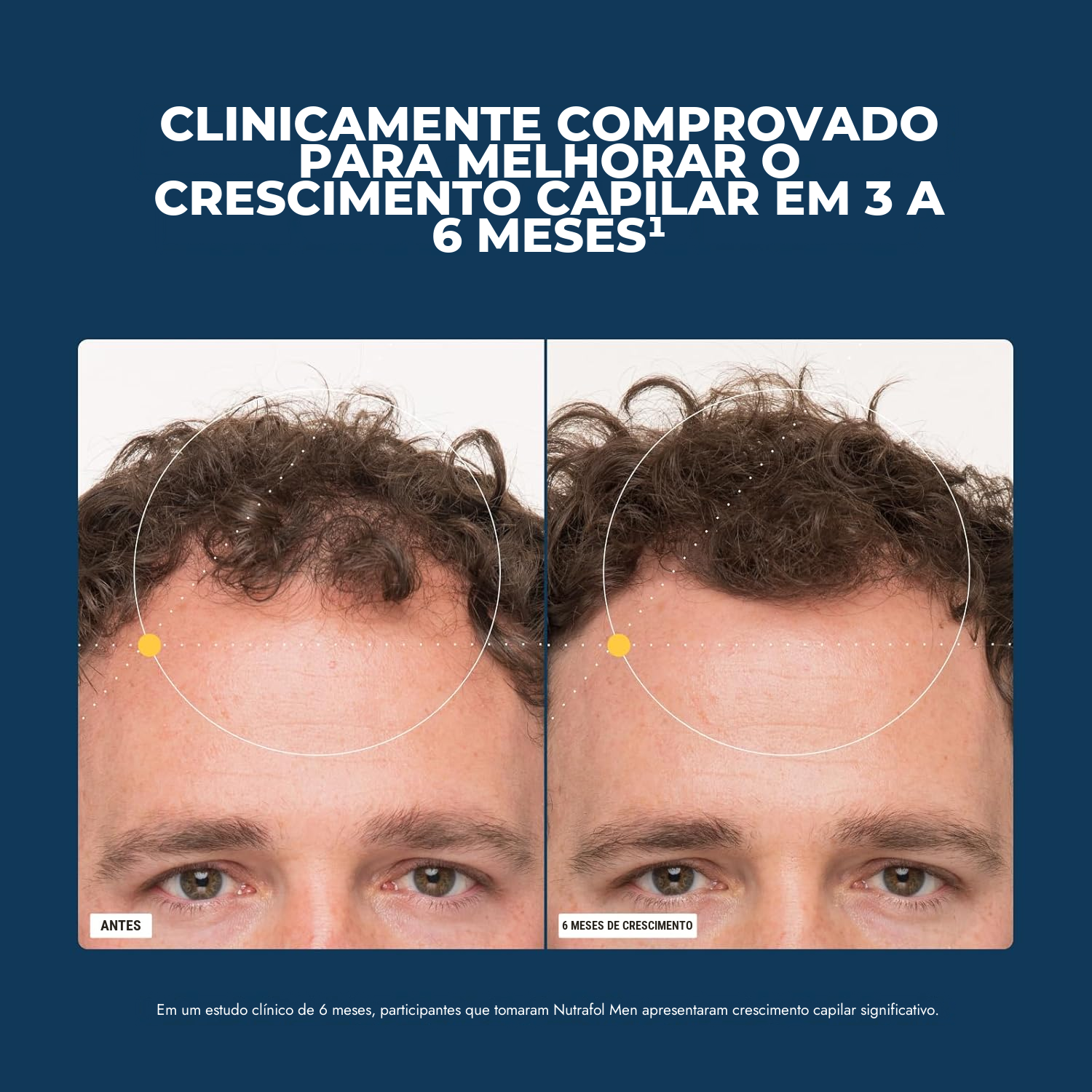 Nutrafol for Men (120 Cápsulas)