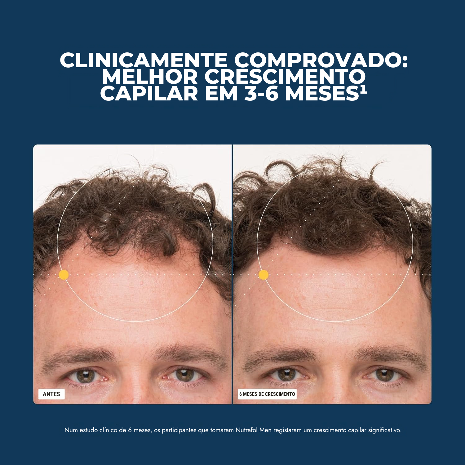 Nutrafol para Homem (120 Cápsulas)