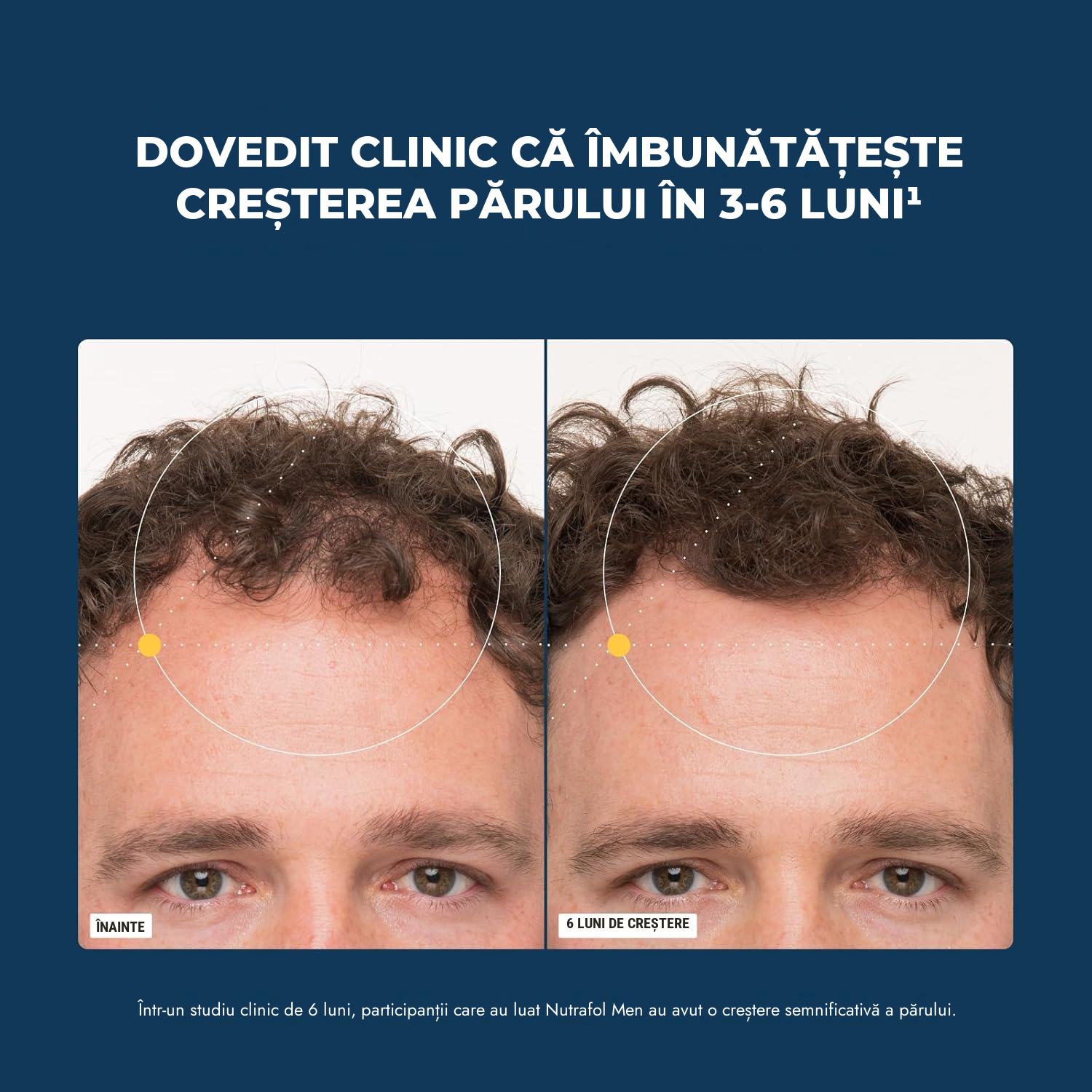 Nutrafol pentru Bărbați (120 Capsule)