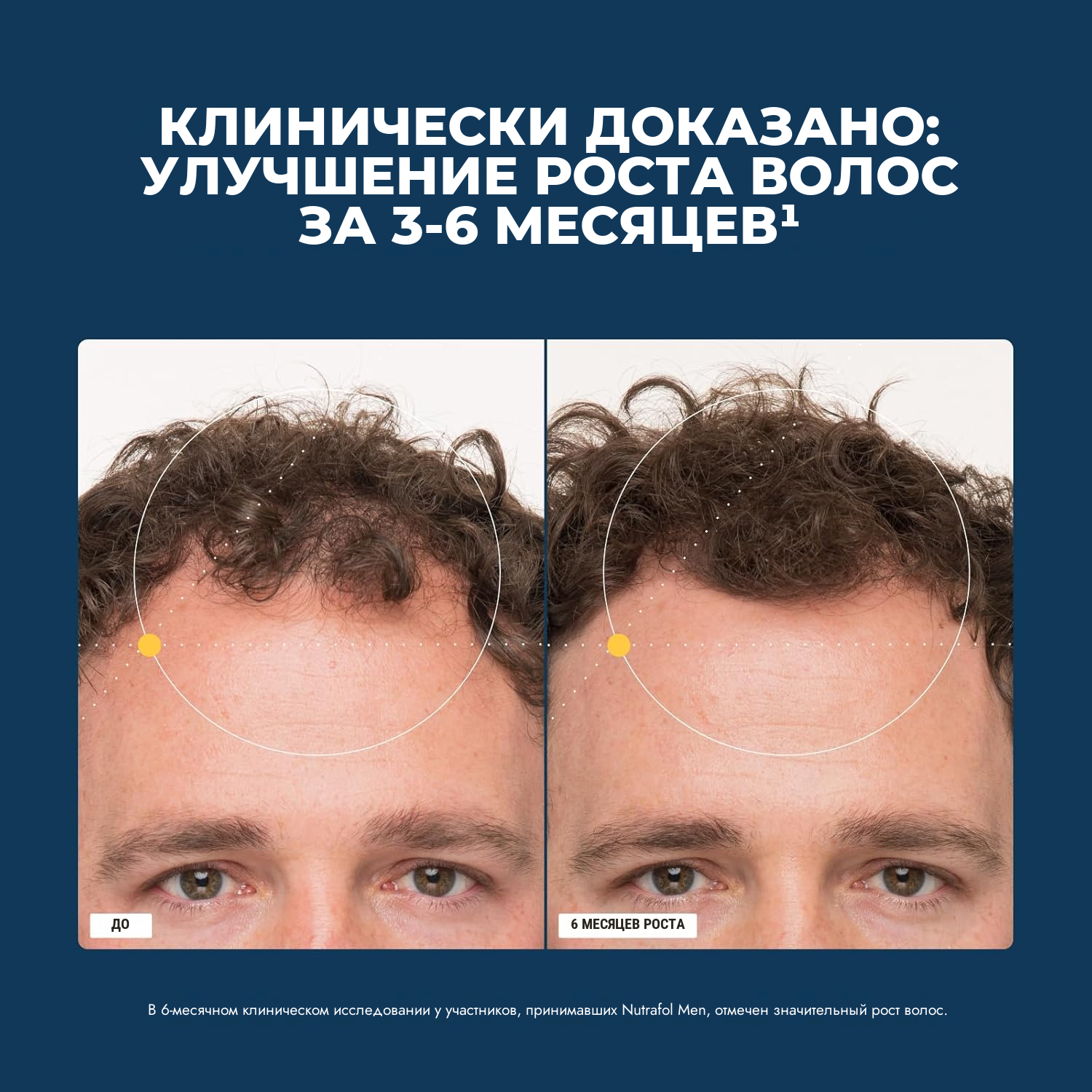 Nutrafol для мужчин (120 капсул)