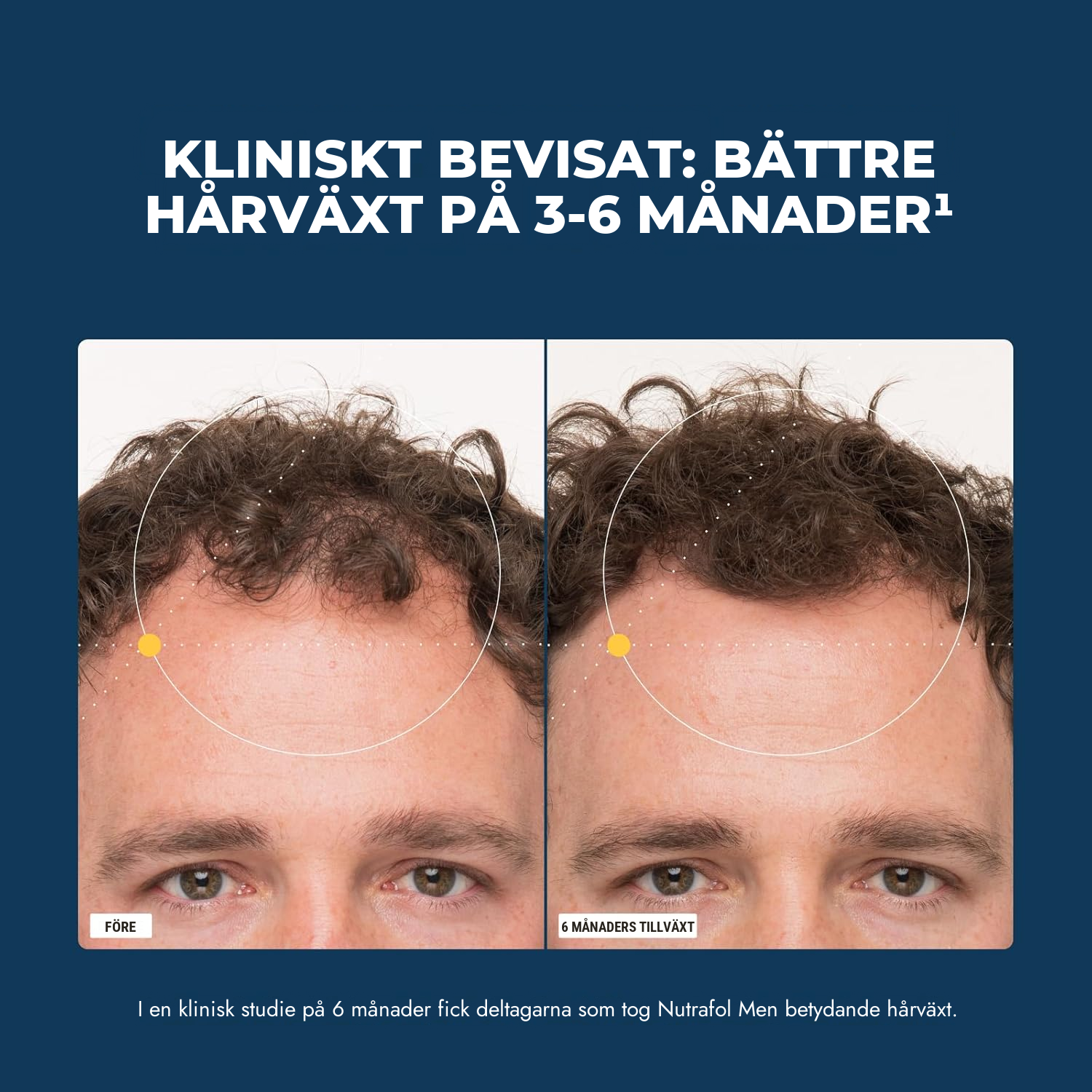 Nutrafol för män (120 kapslar)