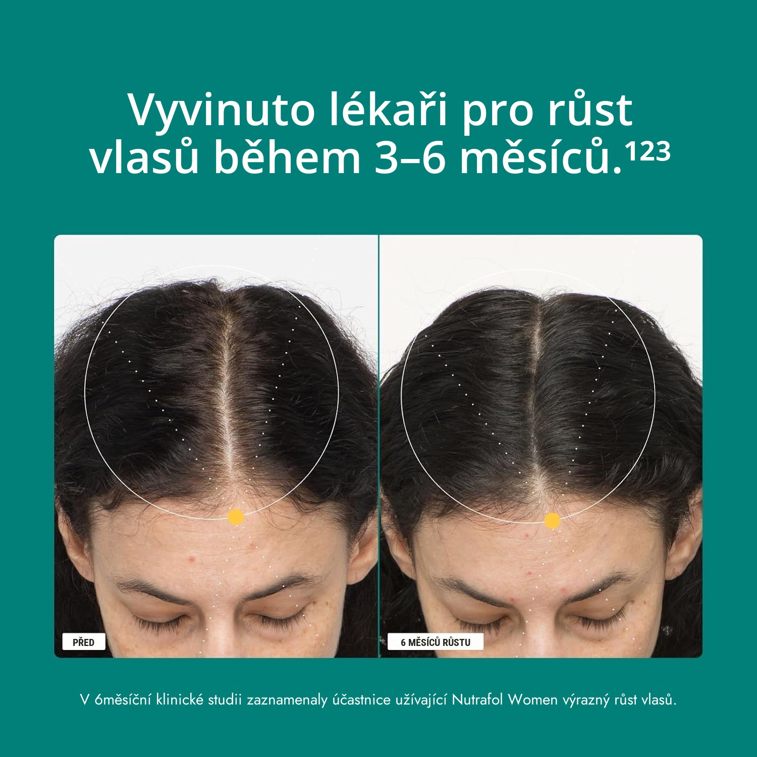 Balení Nutrafol for Women 18-44 se štítkem se složením doplňku