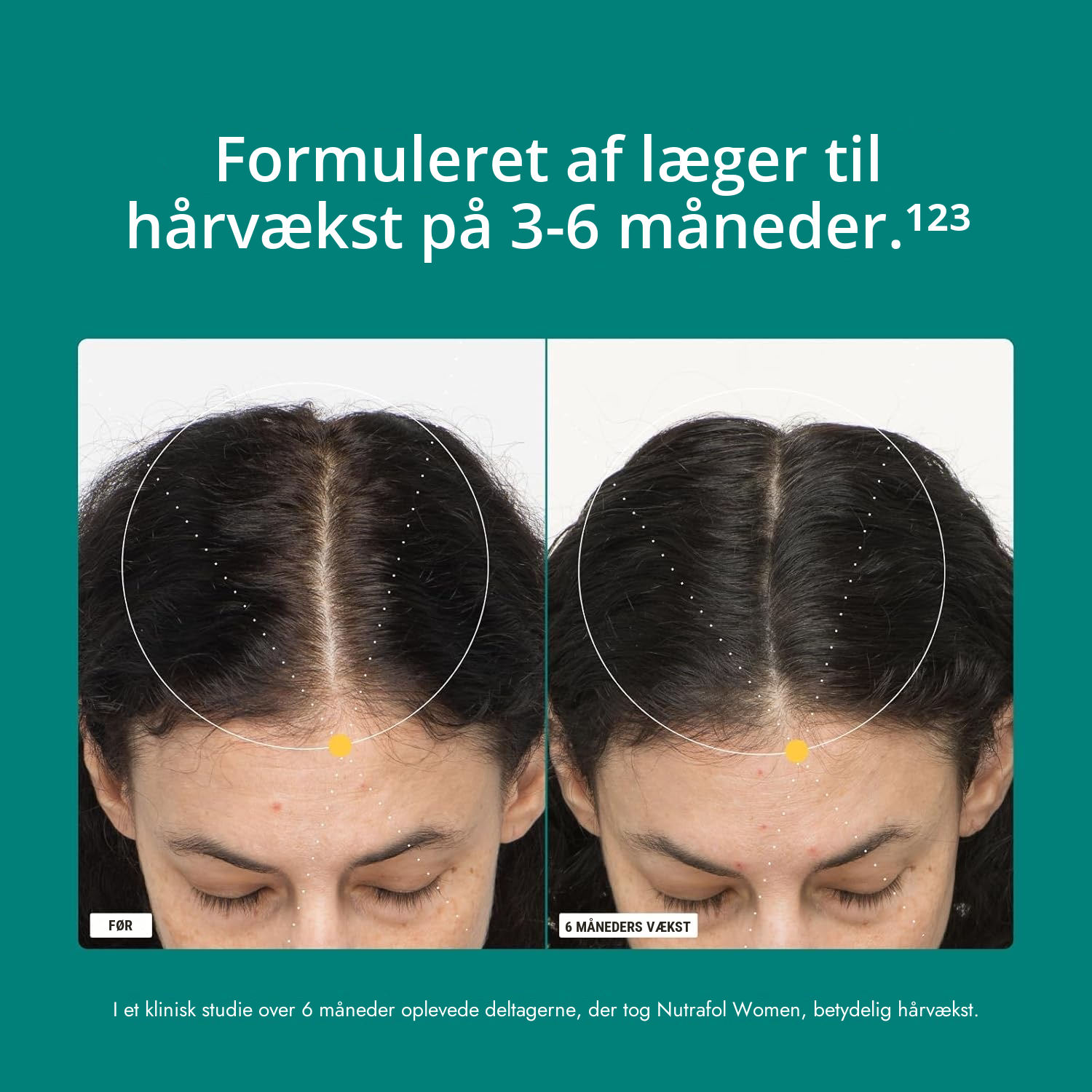 Nutrafol for Women 18-44 pakke med indholdsdeklaration synlig