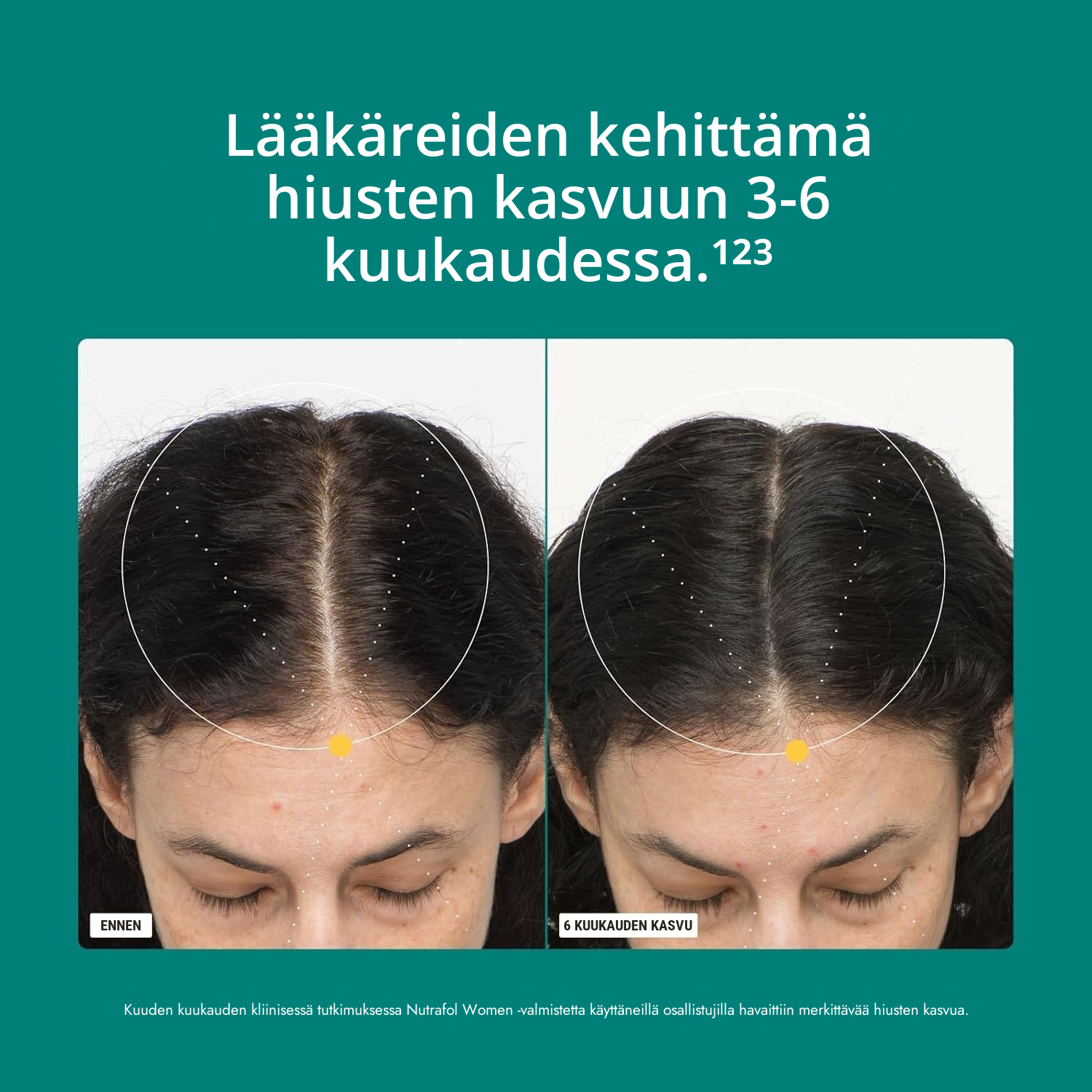 Nutrafol for Women 18-44 -pakkaus, näkyvissä ravintosisältömerkintä