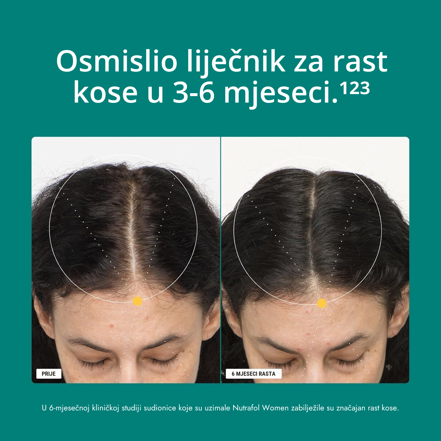 Nutrafol for Women 18-44 pakiranje s prikazom deklaracije dodatka prehrani