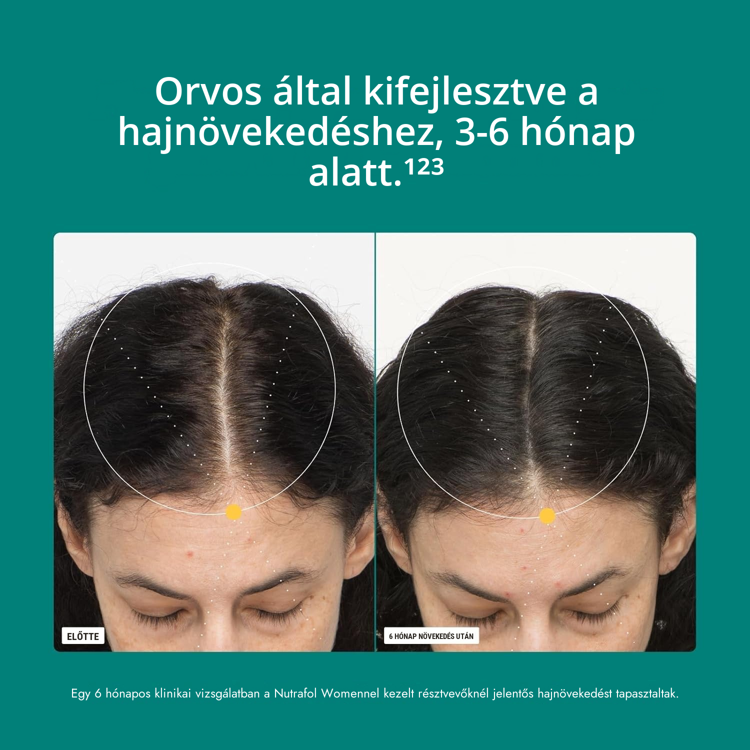 Nutrafol for Women 18-44 csomag, összetevő-táblázat látható
