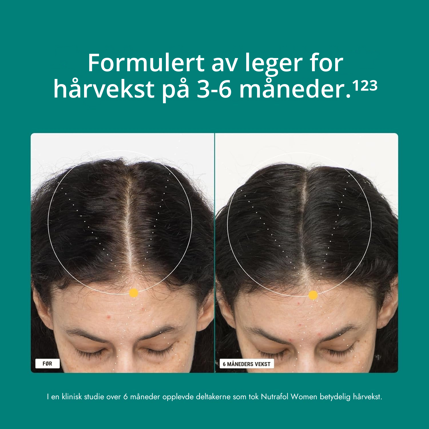 Nutrafol for Women 18-44 pakke med innholdsdeklarasjon synlig