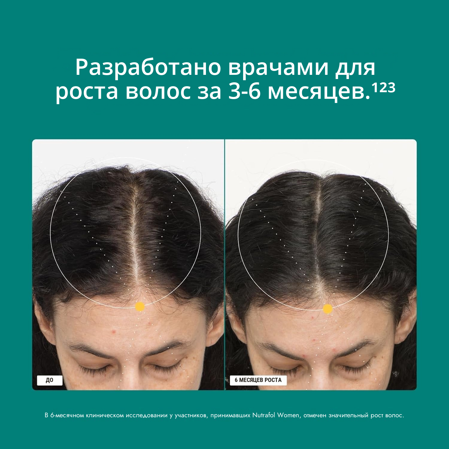 Упаковка Nutrafol для женщин 18-44 с этикеткой состава