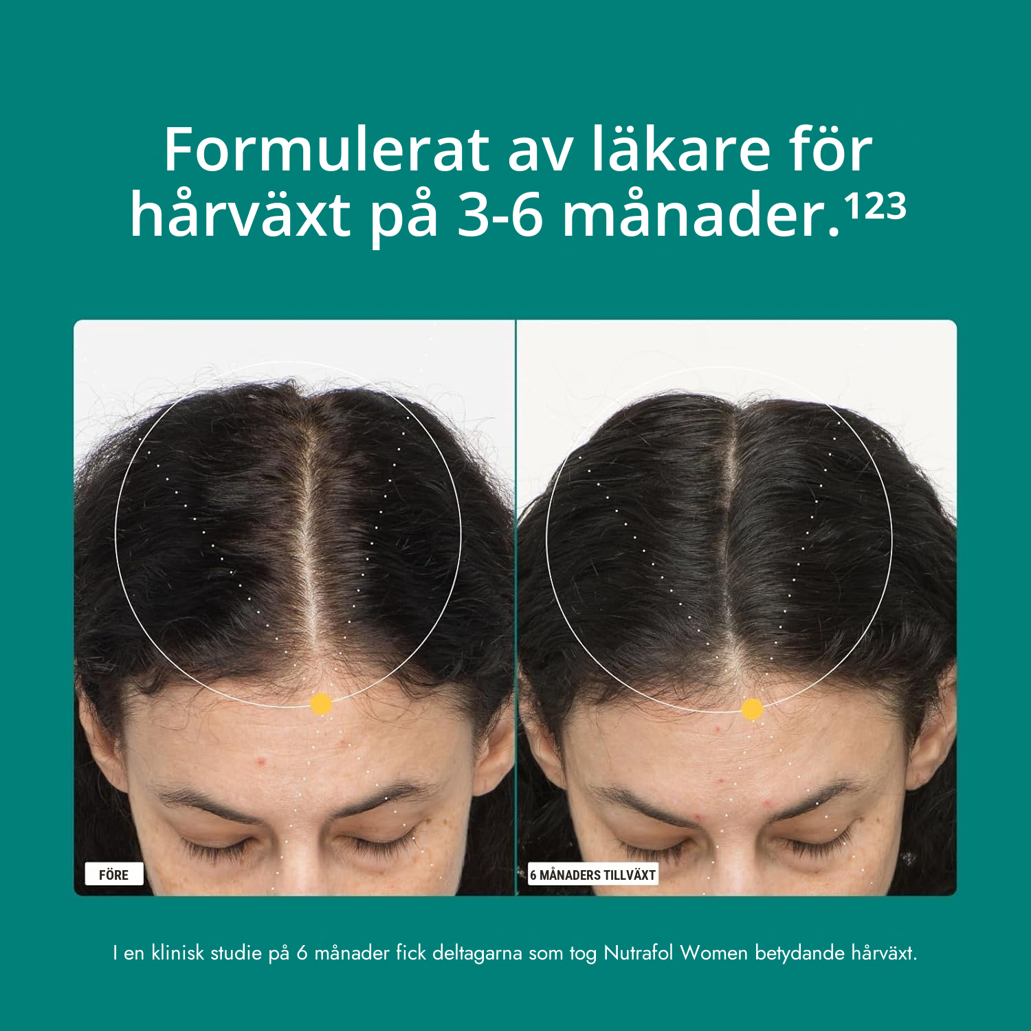 Nutrafol for Women 18-44-förpackning som visar innehållsdeklarationen