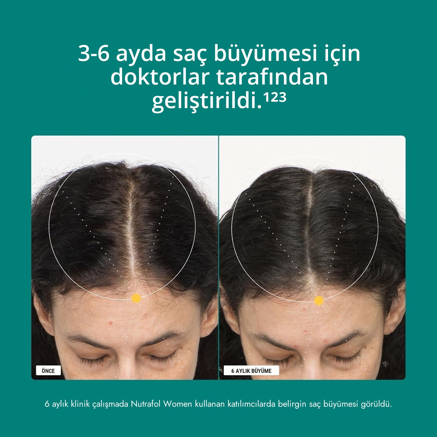 Nutrafol for Women 18-44 paketi, besin değerleri etiketi görünür