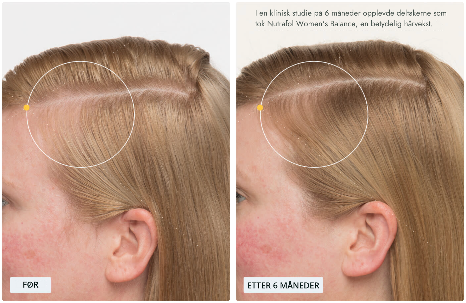 Nutrafol for kvinner 45+ (120 kapsler)