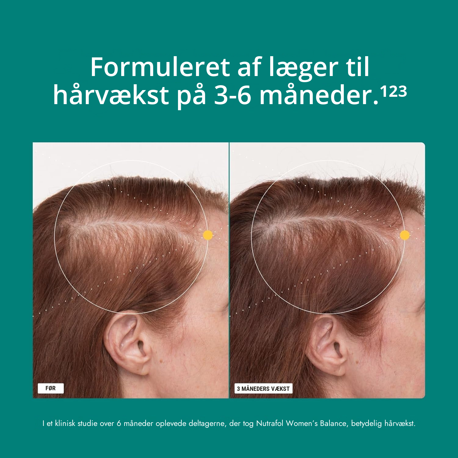 Nutrafol til Kvinder 45+ (120 kapsler)