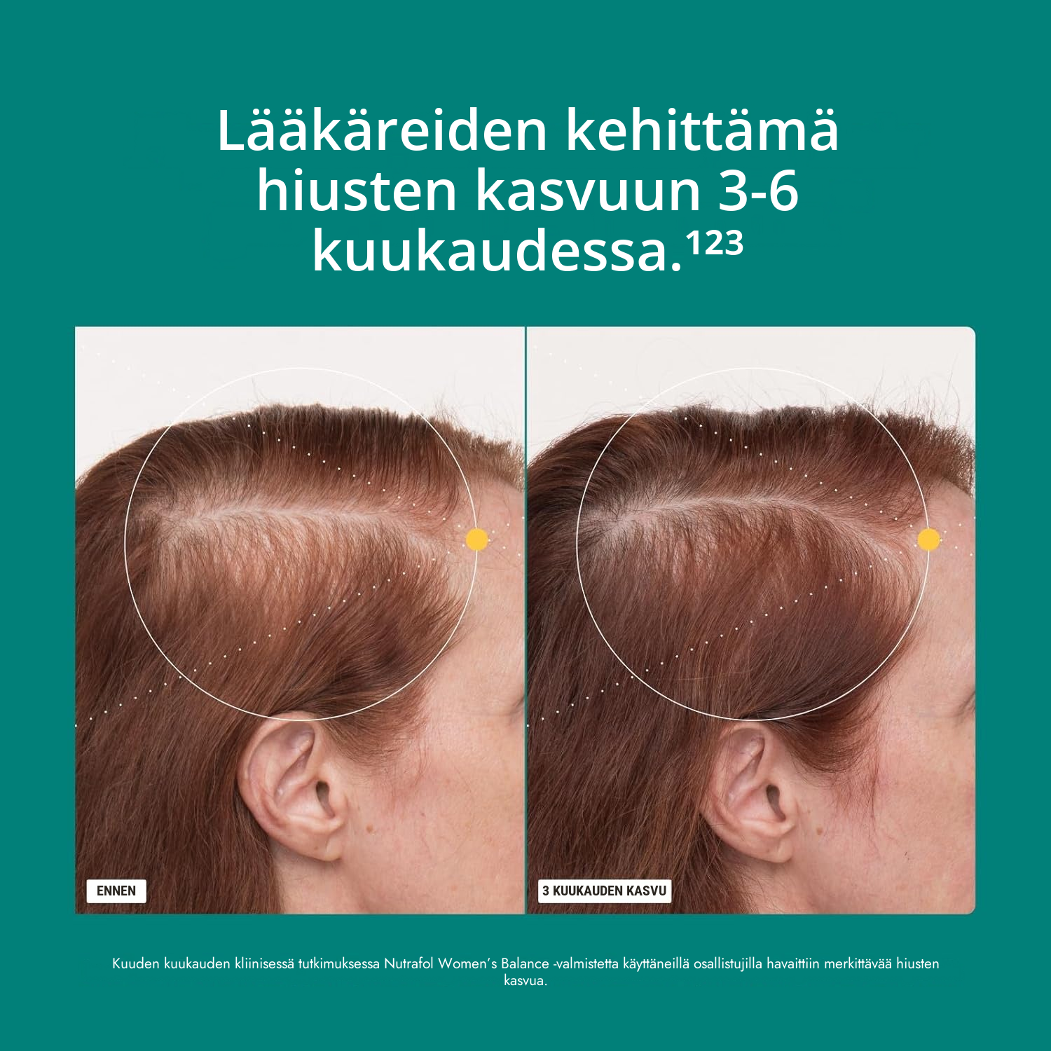 Nutrafol naisille 45+ (120 kapselia)