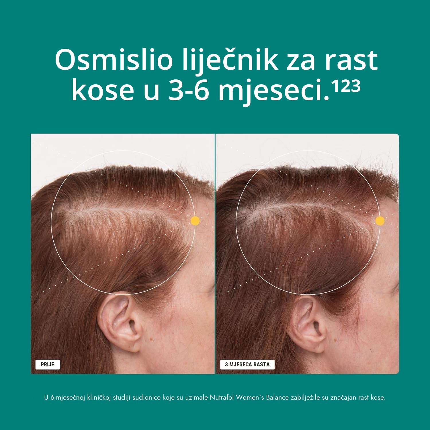 Nutrafol za žene 45+ (120 kapsula)