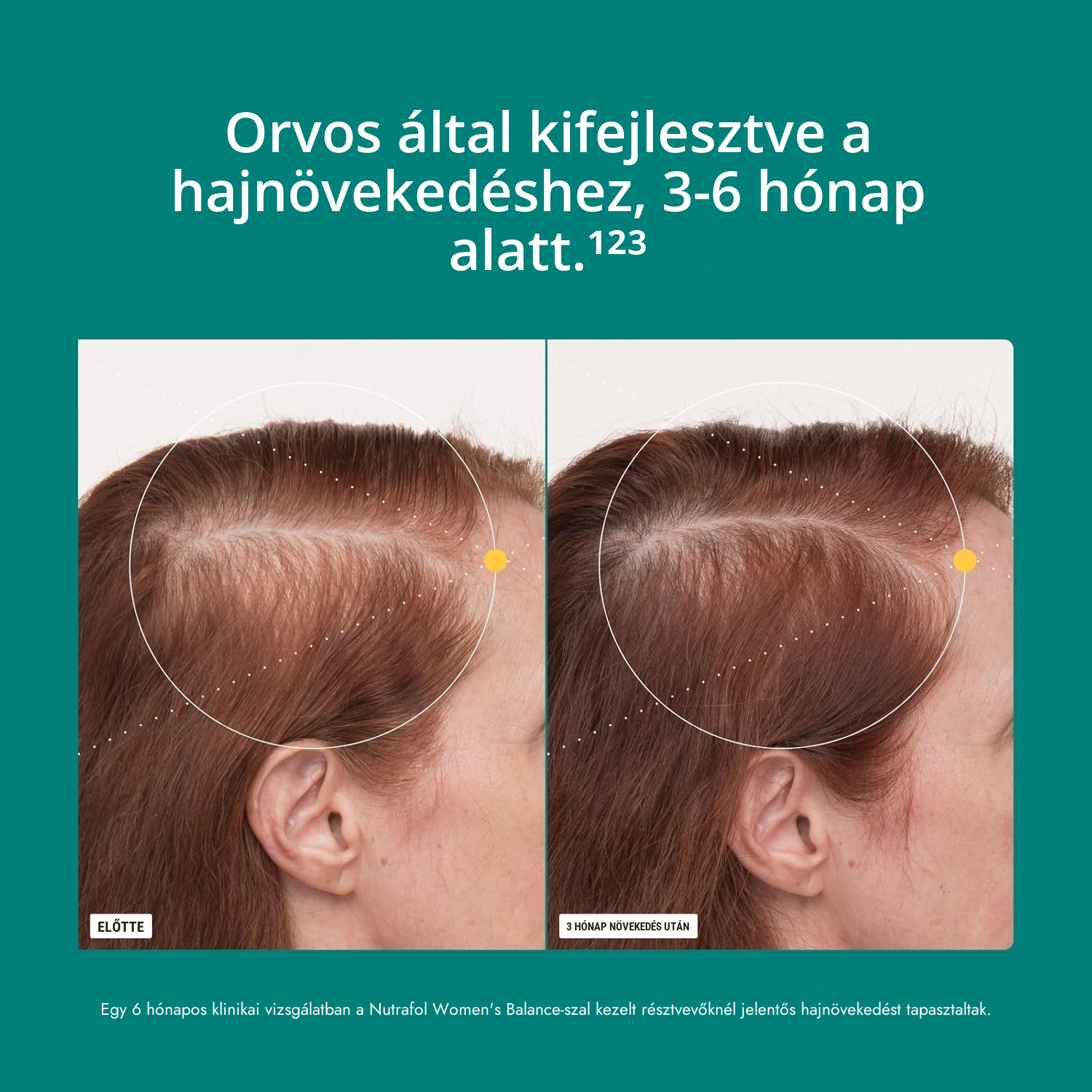 Nutrafol Nőknek 45+ (120 Kapszula)
