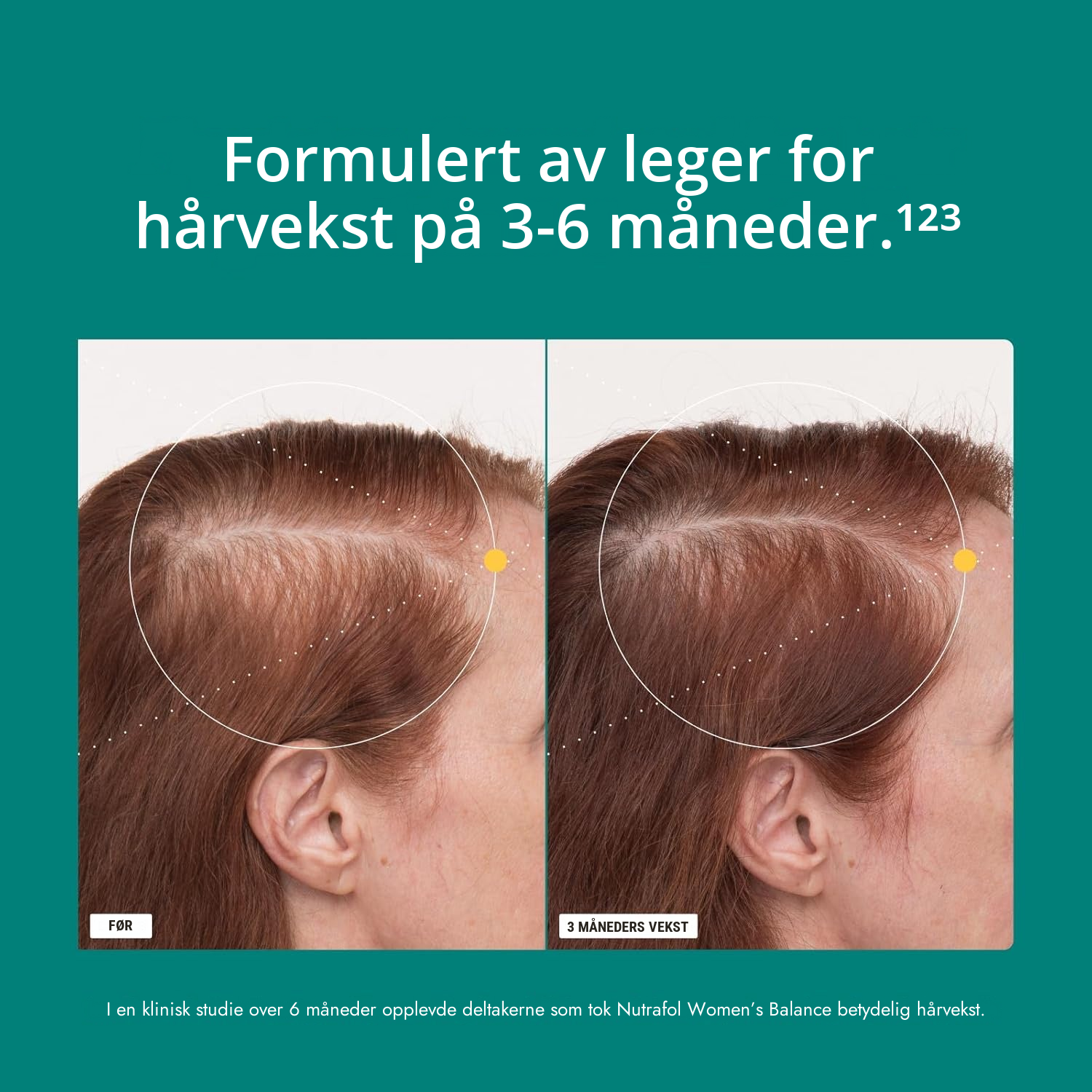 Nutrafol for kvinner 45+ (120 kapsler)